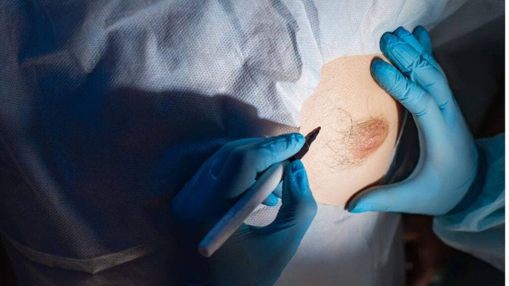 Wie wir Tubuläre Brust korrigieren – Ihre Ästhetische Klinik in Bochum