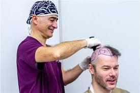 Haartransplantation Türkei Kosten: Kostengünstige Wege zur Haarwiederherstellung aufdecken